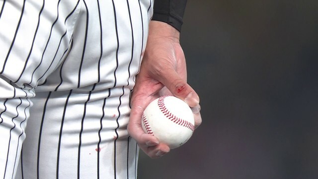 阪神・才木浩人投手の右手親指から出血のアクシデント