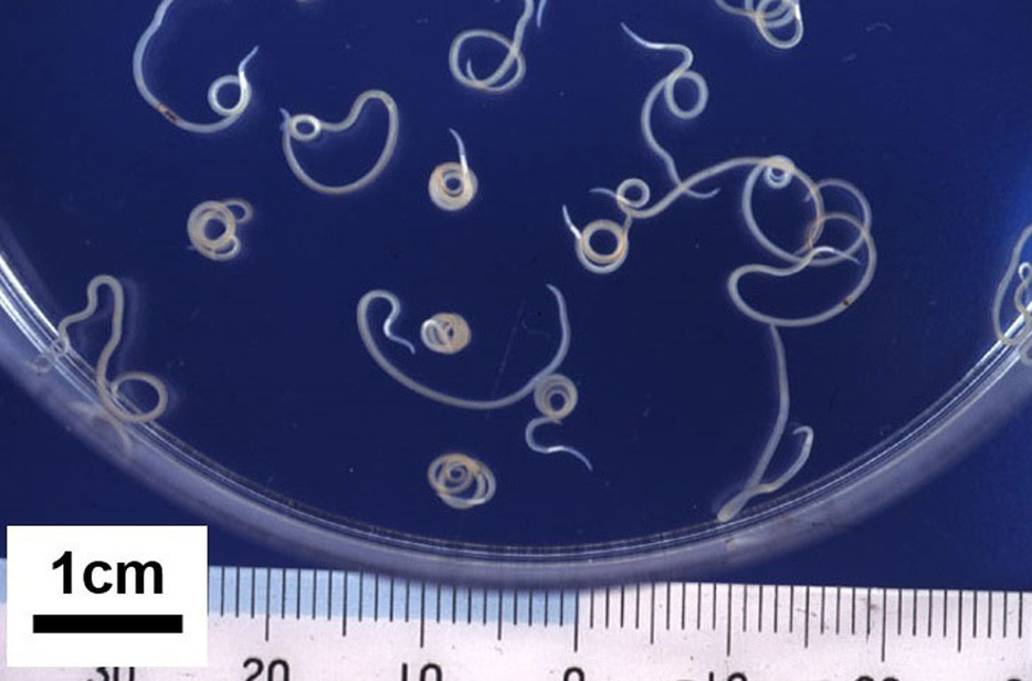 アニサキスの幼虫（国立感染症研究所提供）