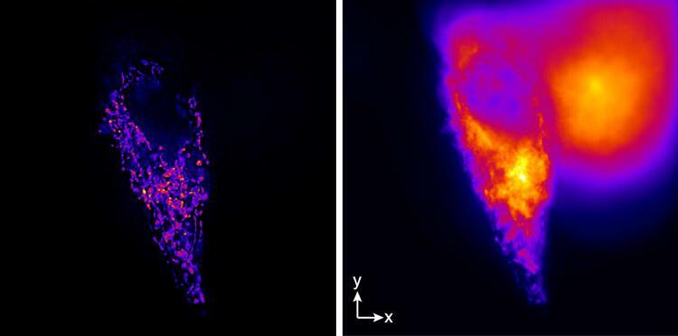 通常の顕微鏡（右）とSPA-SIMで見た細胞内にあるミトコンドリアの蛍光像。従来のSIMよりもコントラストが高くて高分解能だ（大阪大学の天満健太助教提供）