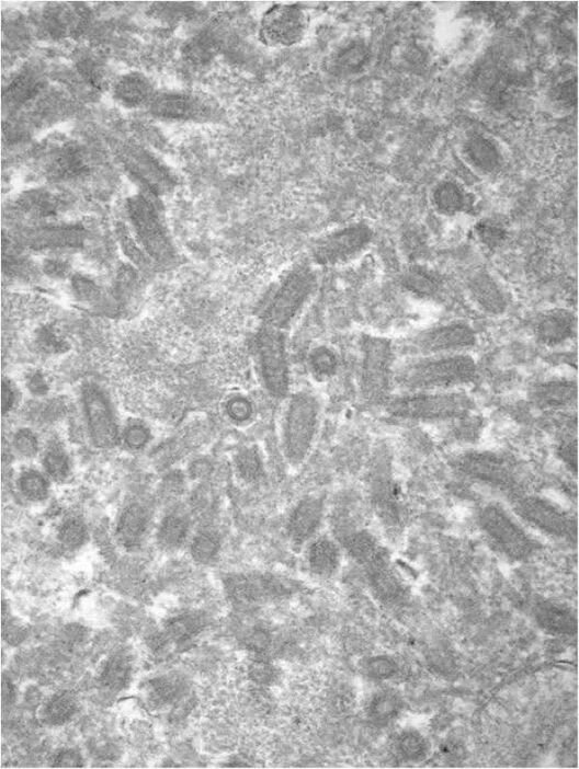 狂犬病ウイルスの電子顕微鏡写真（国立感染症研究所提供）