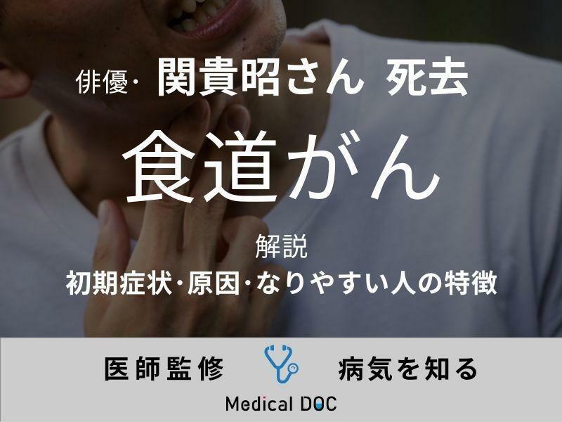 俳優・関貴昭さん逝去 死因の「食道がん」の初期症状・原因・なりやすい人の特徴を医師が解説