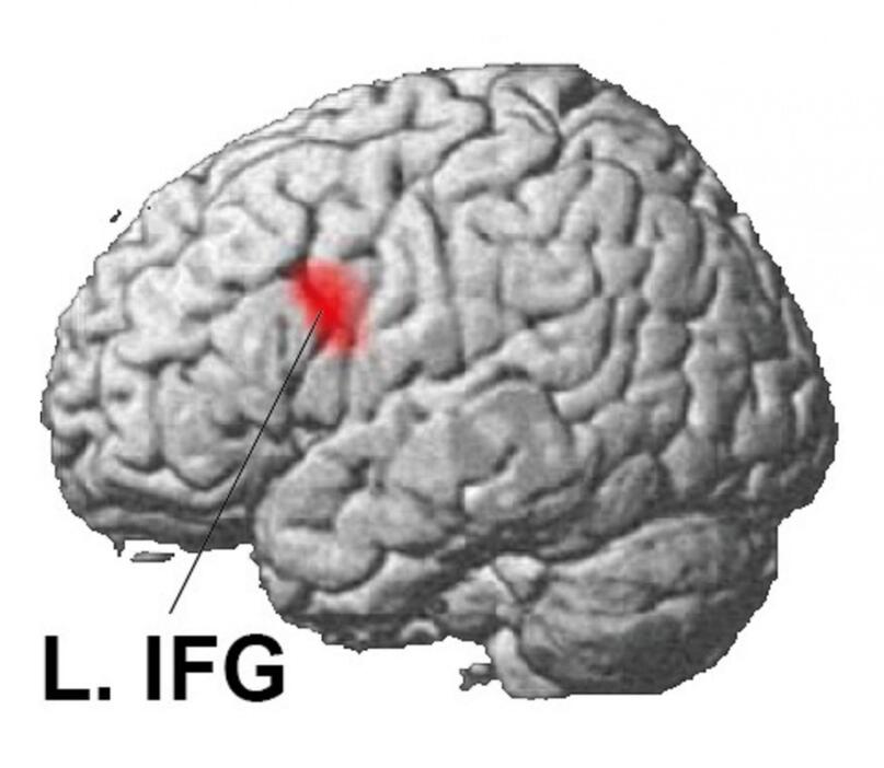 言語を習得する際に活発に働く脳の領域（左下前頭回を意味する「L.IFG」で示した部分）（酒井邦嘉・東京大教授提供）