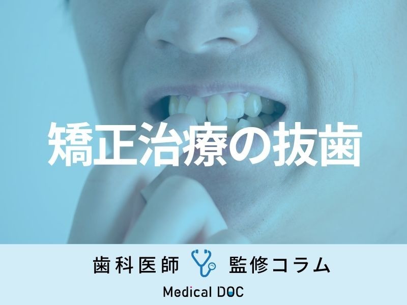 矯正治療で歯を「抜く・抜かない」の判断基準は? 抜歯が必要な理由やメリット・デメリットを解説