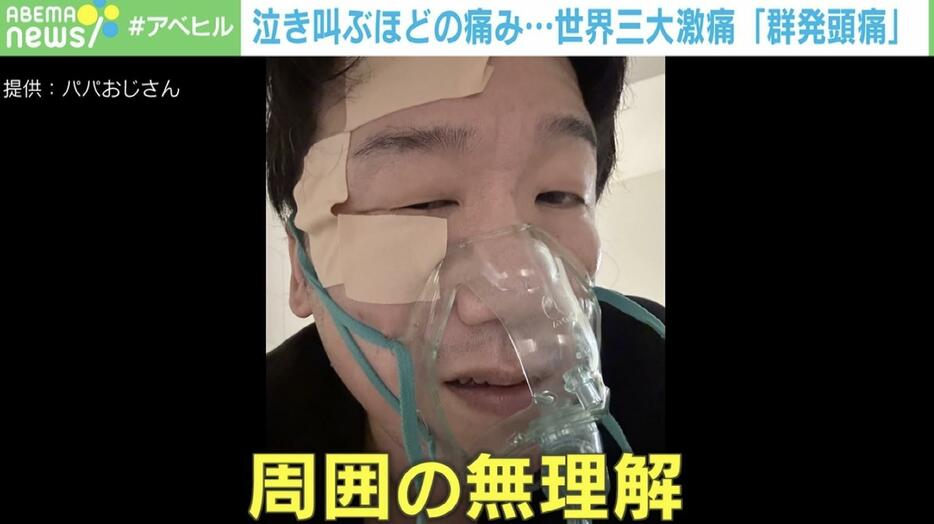 「群発頭痛」に苦しむパパおじさん