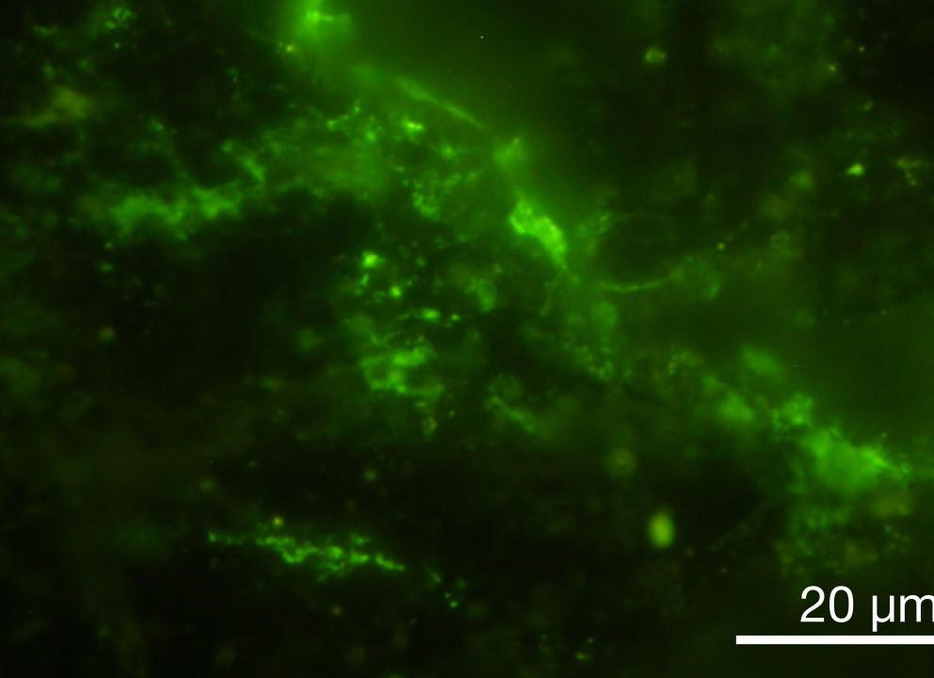 20億年前の地層から見つかった微生物。緑色に着色されている（東京大提供）