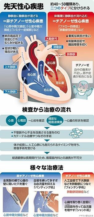 2タイプに分けられる先天性心疾患