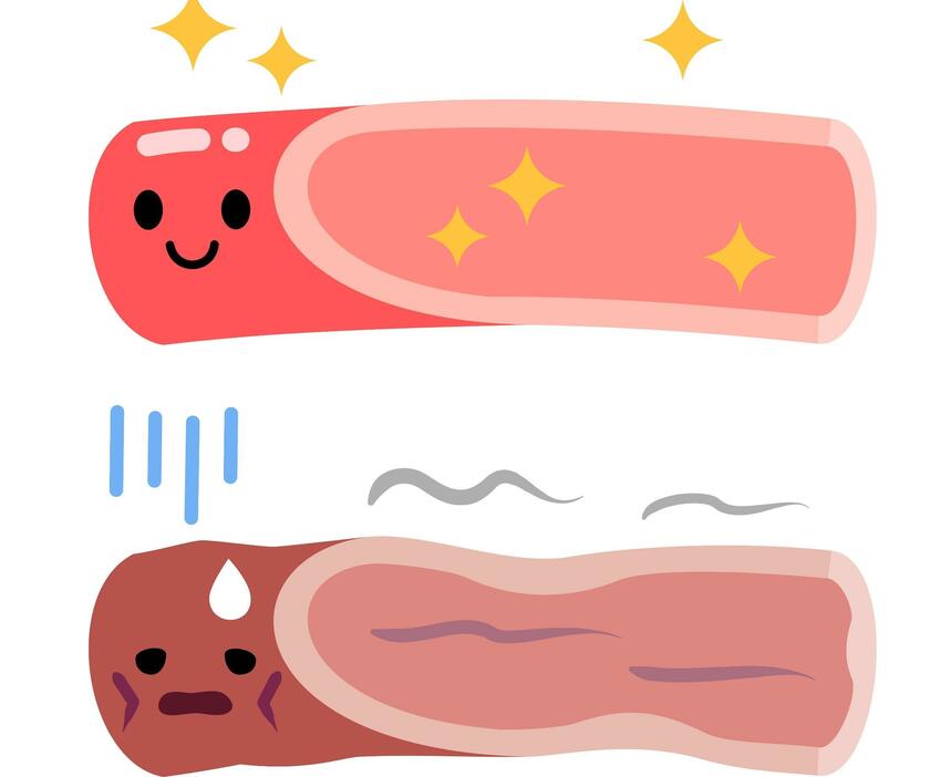 しなやかな血管と硬くなった血管