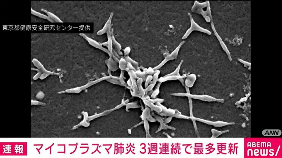 マイコプラズマ肺炎の患者数 過去最多を更新