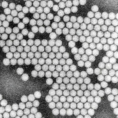 手足口病を引き起こすエンテロウイルスの一種=国立感染症研究所提供