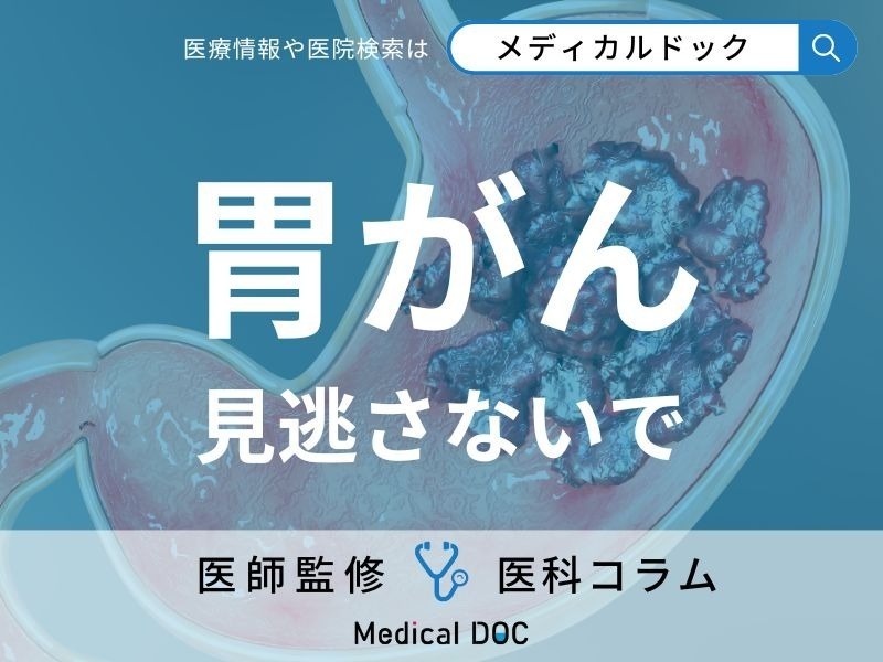 初期症状がない「胃がん」を早く見つける方法はご存じですか? 胃がん検診の流れや注意点も医師が解説