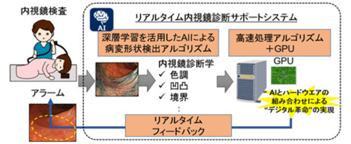 AIを活用した大腸がんチェックシステムの概念図（国立がん研究センター／NEC提供）