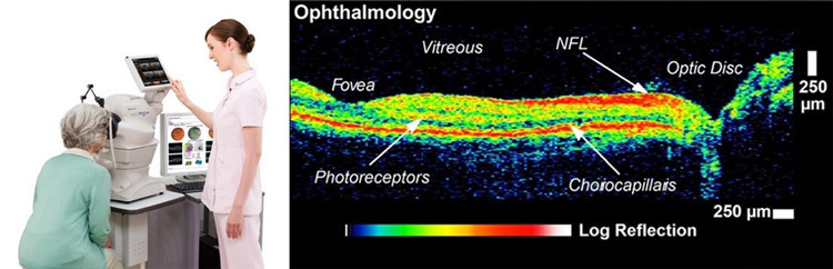 （左）眼底カメラが一体となった最新型OCT装置（本田財団提供）、（右）OCTによる眼底の画像（「M・ヒーほか、アーカイブス・オブ・オフサルモロジー 1995」提供）