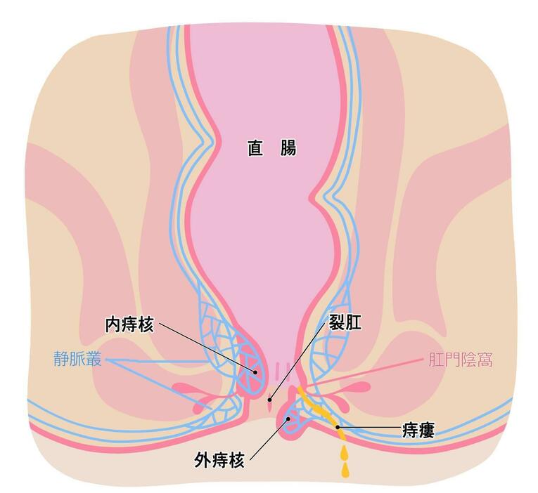 肛門周辺の組織と痔の種類