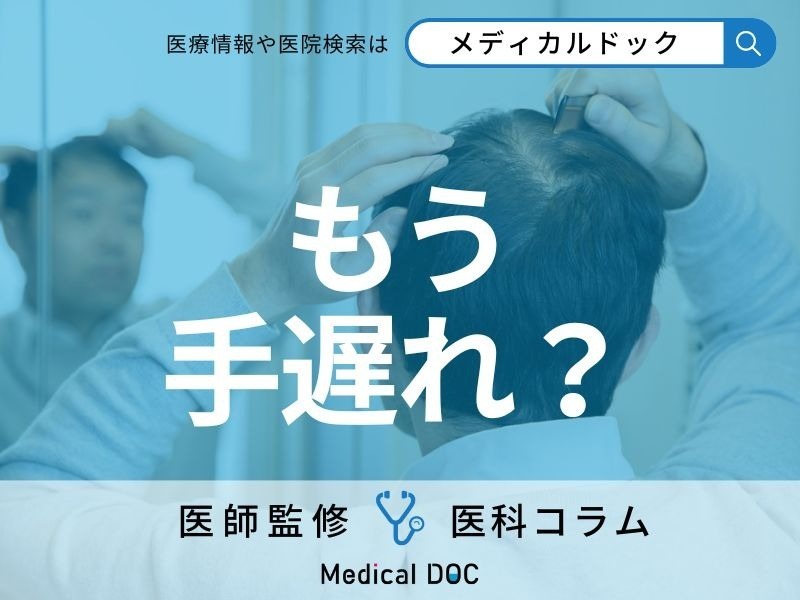 その「薄毛」まだ間に合う!? AGAはどのレベルまで治療できるかご存じですか?