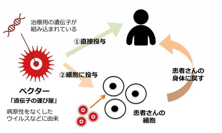 [イラスト5]遺伝子治療には、ベクターを患者に直接投与する方法と、体外に取り出した患者の細胞にベクターを投与して再び患者に移植する方法がある