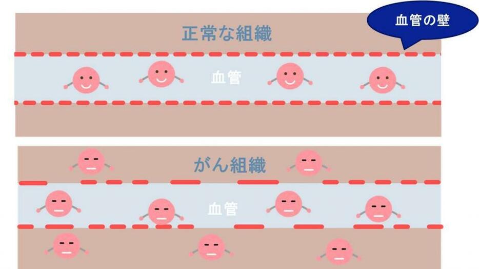 [図解]正常な組織とがん組織の血管のイメージ図