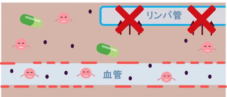 [図解]がん組織では血管から漏れ出た成分がリンパ系に回収されにいので、抗がん剤が長時間がん組織内に留まる