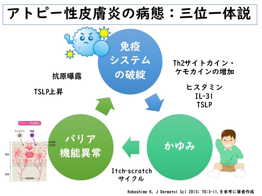 アトピー性皮膚炎の病態：三位一体説（※6）（図解作成：堀向健太医師）