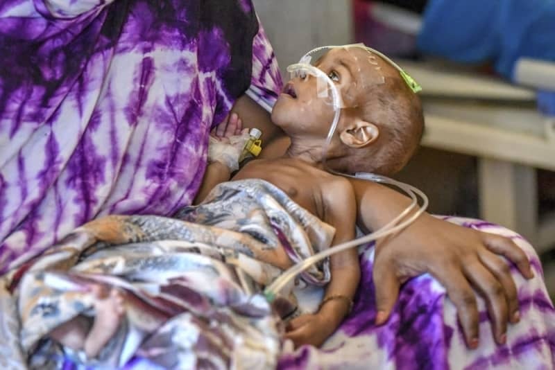 バナディル病院で治療を受けるやせ細った子ども＝５月１５日、ソマリア・モガディシオ（中野智明氏撮影・共同）
