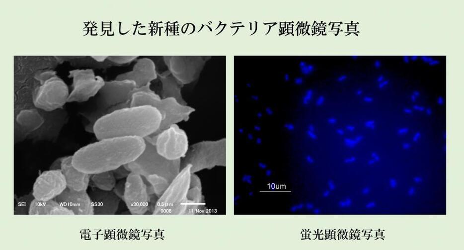 ［図1］発見した新種のバクテリアColwellia marinimaniae （コルベ リア　マリニマニエ）の顕微鏡写真、左が電子顕微鏡、右が蛍光顕微鏡（提供：和歌山高専・楠部准教授）