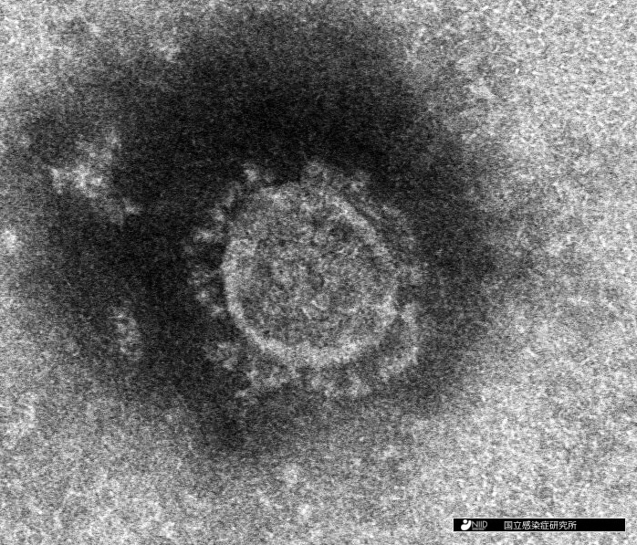 [画像]国立感染症研究所が分離に成功した新型コロナウイルス。周囲に王冠のような球状の突起が見える（提供：国立感染症研究所）