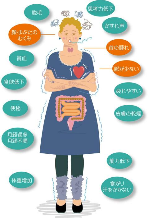 甲状腺機能低下症のおもな症状