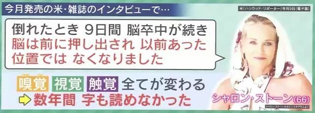 9日間続いた脳卒中で、脳の位置が移動