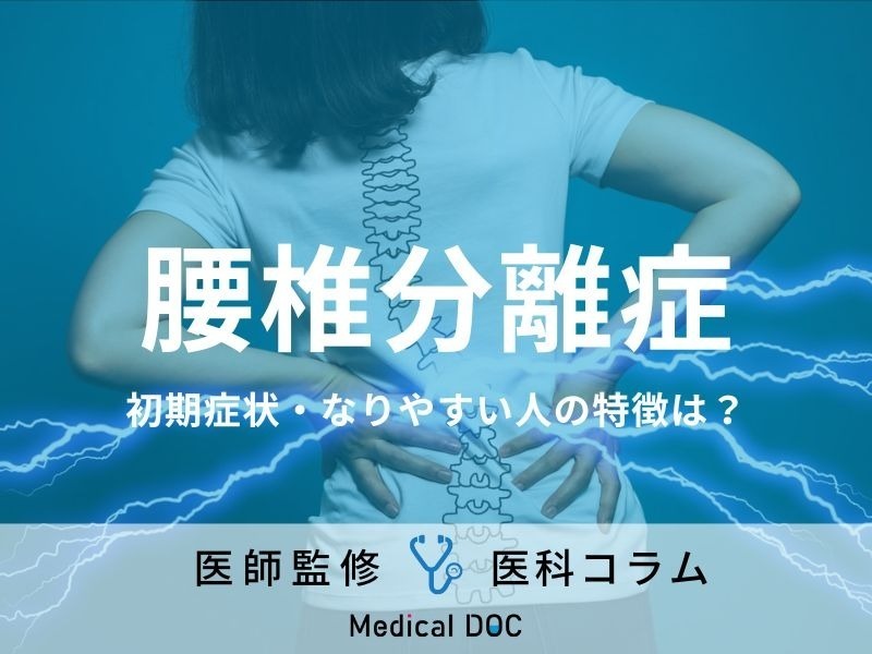 腰椎分離症の初期症状はご存じですか? なりやすい人の特徴・予防法も医師が解説!