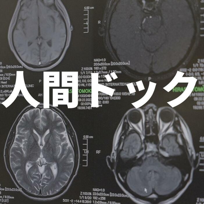 【密着】人間ドックで心筋梗塞・脳梗塞リスクを調べた結果～進化する医療～