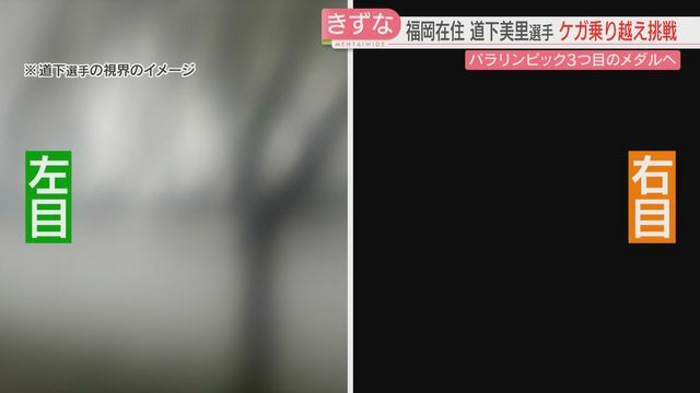 道下選手の視界のイメージ