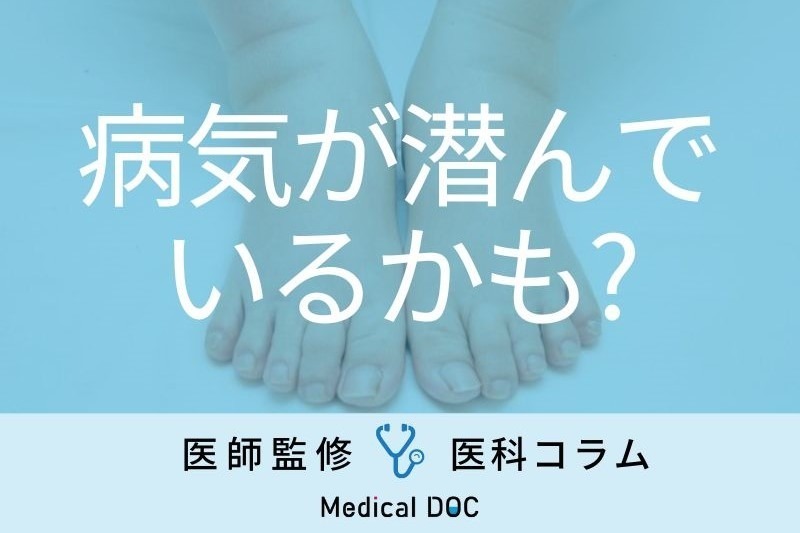 むくみの陰に潜む病気とは? 塩分だけじゃない原因と効果的な対策を医師が解説