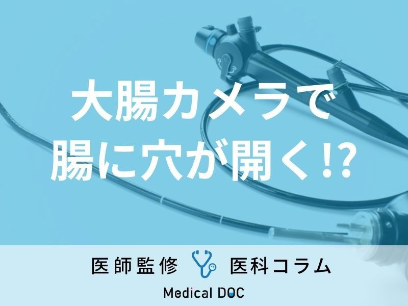 「大腸カメラ」で“腸に穴が開く”可能性があることをご存じですか? 合併症やリスクを医師が解説!