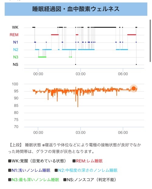 ↑ミホの睡眠経過図。睡眠の状態がグラフで可視化される