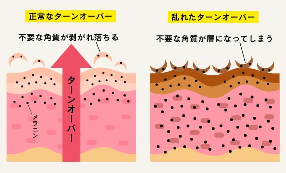 ターンオーバーのメカニズム