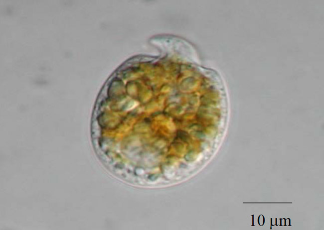 「渦鞭毛藻」は西表島の浅瀬で見つかった単細胞生物（高知大学 津田正史教授提供）