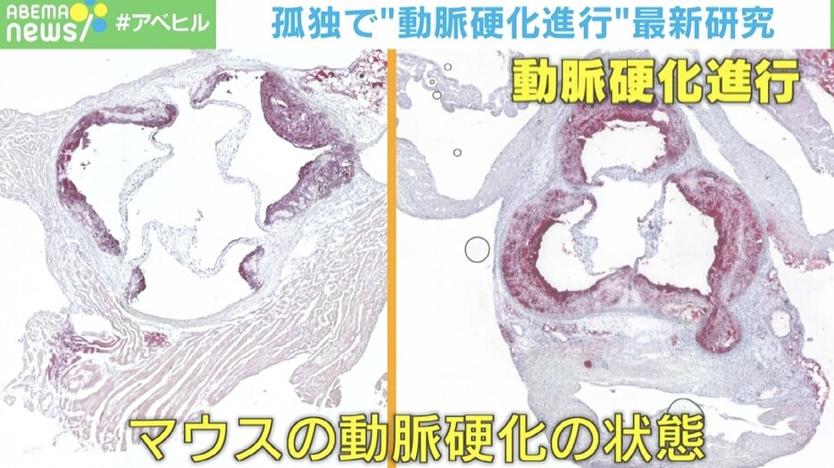 マウスの動脈硬化の状態