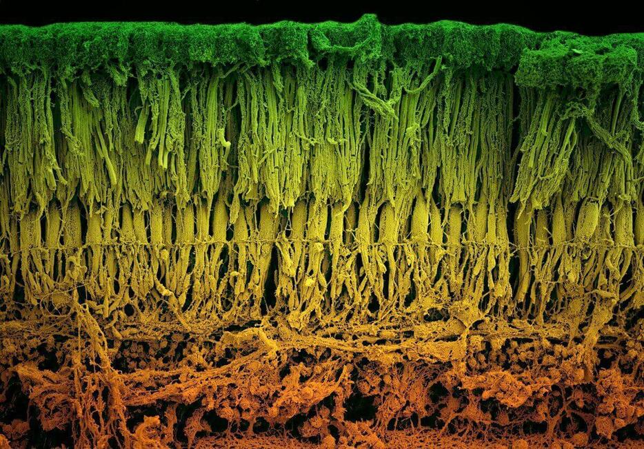 網膜をとらえた走査型電子顕微鏡の着色画像。網膜色素変性症は、目の奥にある網膜と呼ばれる組織層に影響を及ぼす希少な病気だ。網膜の光を感知する部分は、桿体細胞と錐体細胞という光受容体細胞からなる。（Micrograph by Louise Hughes）