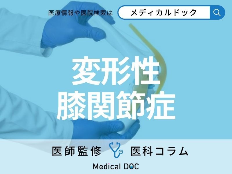 「変形性膝関節症」になりやすい人の特徴はご存じですか? 再生医療・手術による治療法も医師が解説!