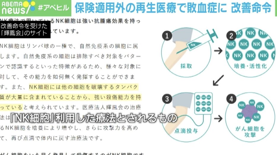 「NK細胞」を利用した療法とされるもの