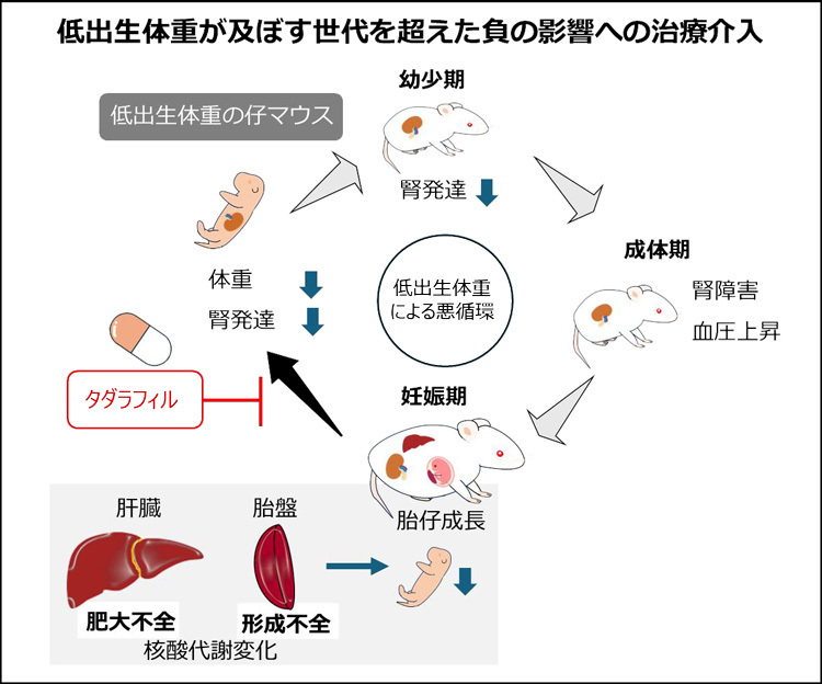 低出生体重が世代を超えて影響を及ぼすことに関する今回の研究のイメージ図（東北大学提供）