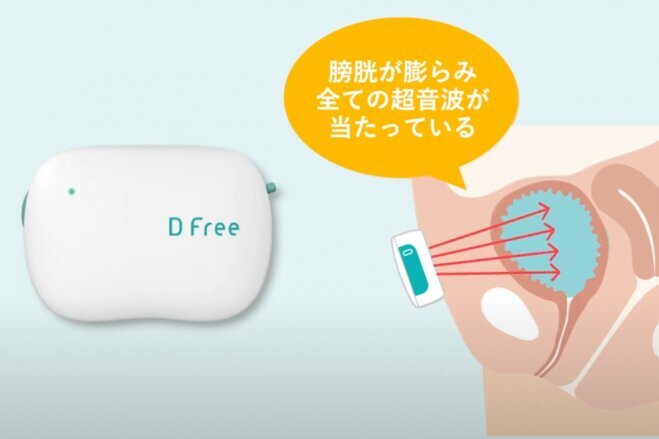 排泄（はいせつ）予測デバイス「DFree」＝DFree提供