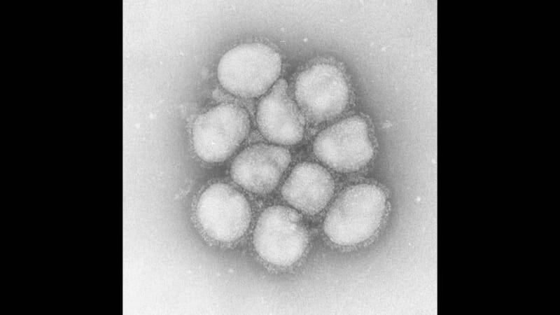 【資料】インフルエンザウイルス（提供：国立感染症研究所）