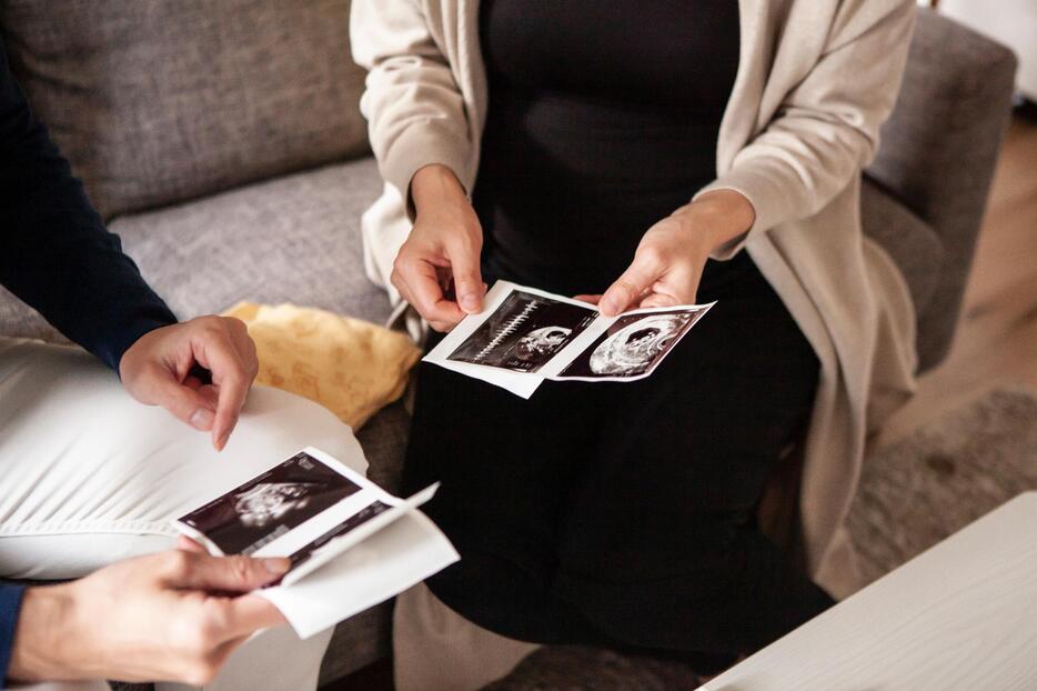 胎児のエコー写真を見る妊婦