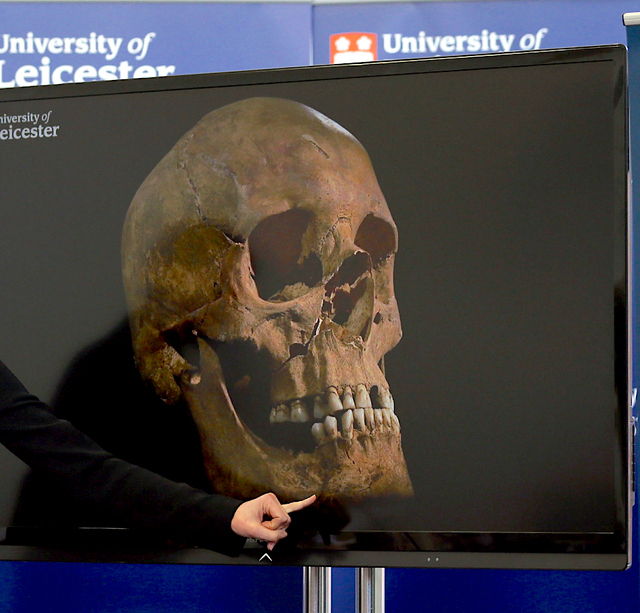 発掘・鑑定にあたったレスター大学が発表した頭骨の写真　photo by gettyimages