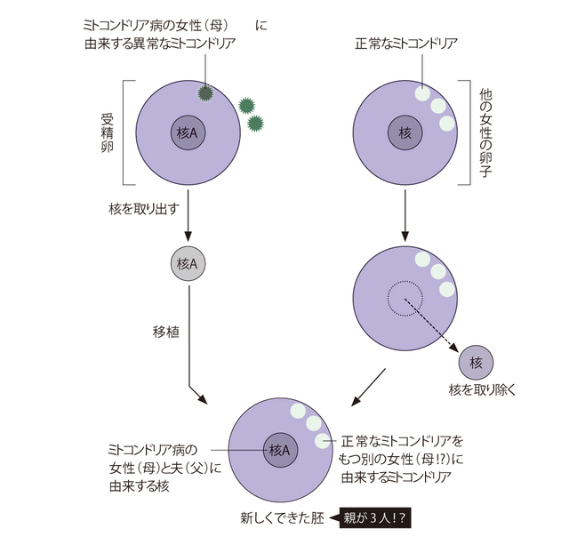 図「核移植による「親が3人いる子ども!?」」異常なミトコンドリアを取り除く方法