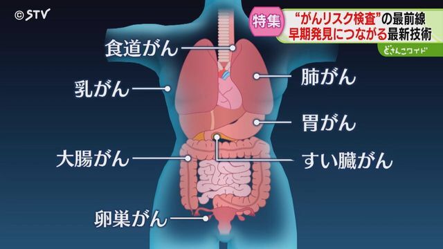 STVニュース北海道