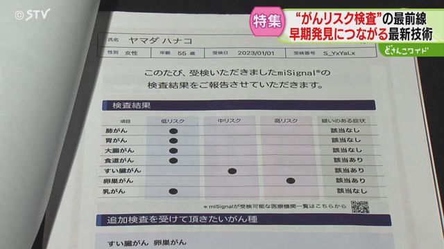 STVニュース北海道