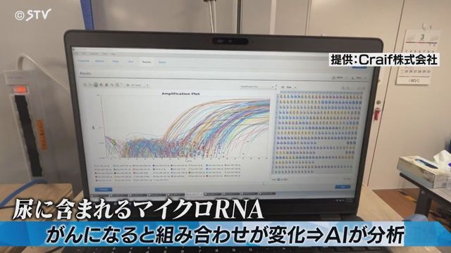 STVニュース北海道