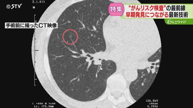 STVニュース北海道