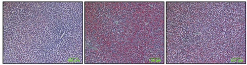【脂肪を赤く染色させたマウスの肝臓切片の顕微鏡画像（左から）エタノールを投与していないマウス、エタノールを投与したマウス、エタノールとPHGGを与えたマウス（三重大提供）】